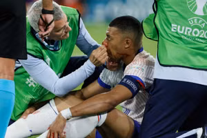 [Ảnh] Gặp chấn thương mũi, Kylian Mbappé để ngỏ khả năng ra sân trận tiếp theo