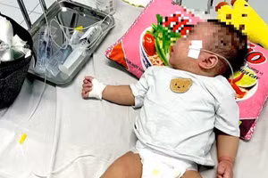 Biểu hiện của sởi là sốt, viêm long đường hô hấp, đường tiêu hóa và kết mạc mắt kèm nổi ban đặc trưng. Sau khi mắc sởi, đáp ứng miễn dịch của cơ thể giảm sút nên trẻ dễ mắc các bệnh nhiễm trùng khác.