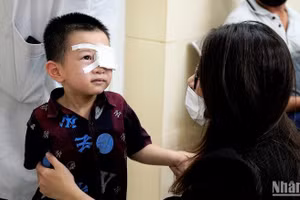 Bệnh nhi được bóc giả mạc tại Bệnh viện Nhi Trung ương. (Ảnh: THẾ KHẢI)