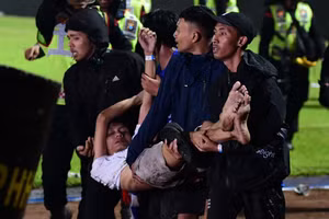 Một nạn nhân trong vụ bạo động tại sân vận động Kanjuruhan ở Malang, Đông Java, Indonesia. Ít nhất 129 người đã tử vong sau vụ việc. (Ảnh: Jakarta Post)