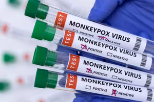 Ống đựng mẫu bệnh phẩm dương tính với virus gây bệnh đậu mùa khỉ. (Ảnh: Reuters)