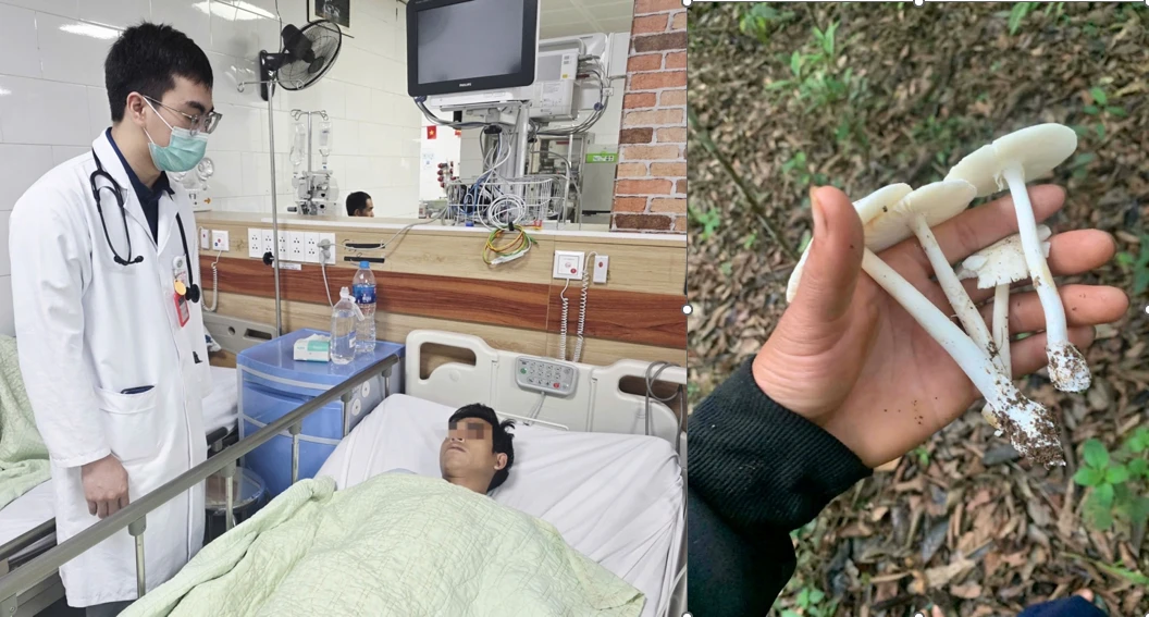 Ngộ độc nấm amatoxin: 2 ca tử vong, cảnh báo nguy hiểm từ nấm rừng