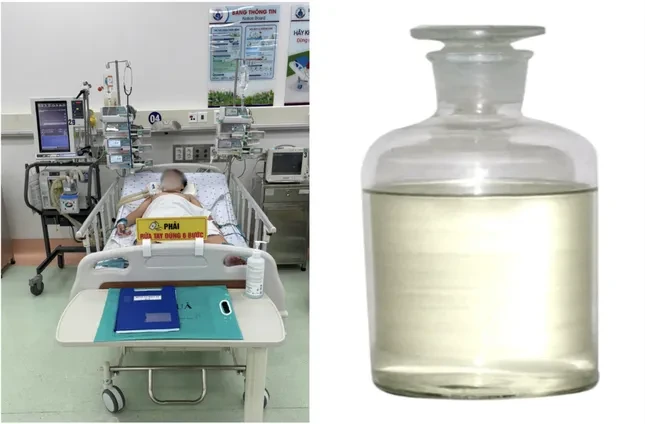 Bé trai đã được bệnh viện cấp cứu kịp thời. (Ảnh: BVCC)