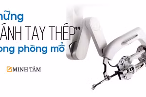 Những “cánh tay thép” trong phòng mổ