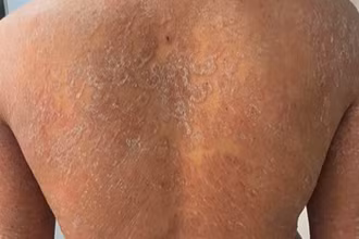 Tình trạng bệnh nhân khi đến khám. 