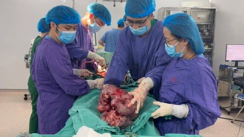 Phụ Nữ Hà Nội Mang Khối U 9kg Trong Bụng Do Chủ Quan Không Khám Sớm
