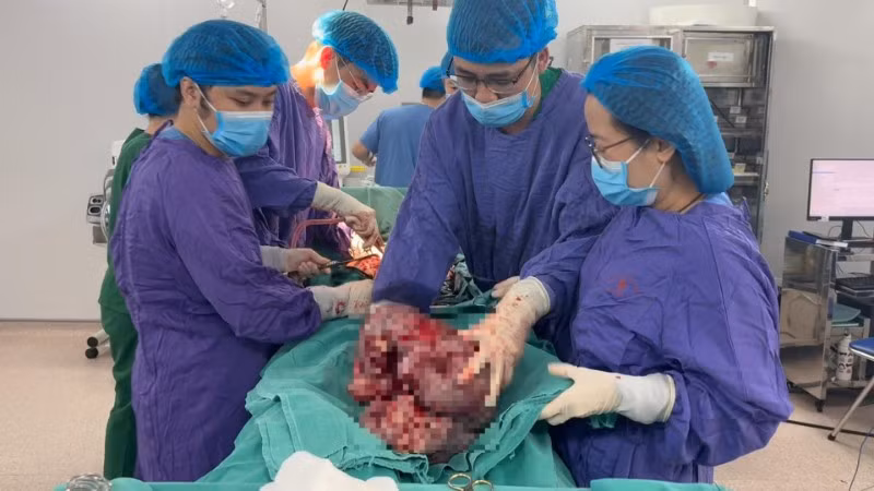 Kíp phẫu thuật xử lý bóc tách khối u.