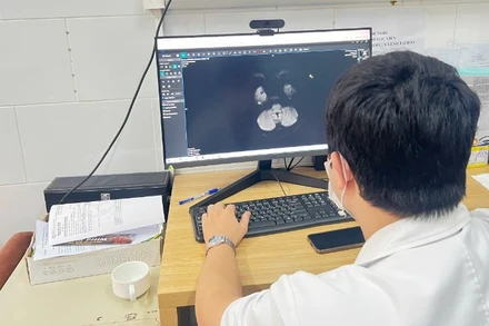 Các bác sĩ đánh giá tổn thương của người bệnh trên kết quả chẩn đoán hình ảnh.