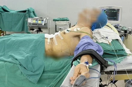 Tư thế nửa nằm nửa ngồi của bệnh nhân trong phòng phẫu thuật.