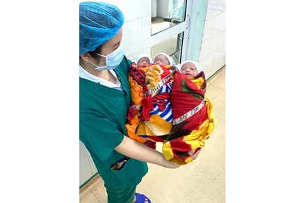 Sản phụ sinh ba cùng trứng hiếm gặp ở Tuyên Quang
