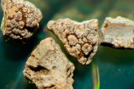 Những mảnh sỏi thận bị tán nhỏ được phóng đại. Ảnh: WD Auer / Alamy.