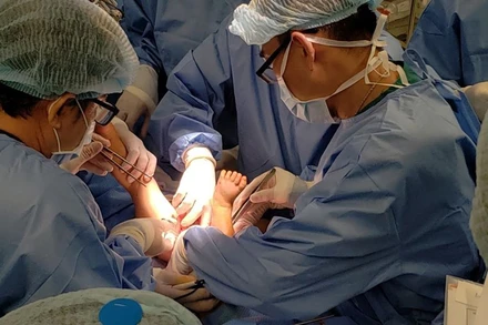 Tách thành công cặp song sinh Trúc Nhi - Diệu Nhi