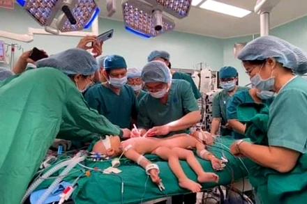 Các bác sĩ bắt đầu cuộc mổ tách dính cặp song sinh Trúc Nhi - Diệu Nhi. 