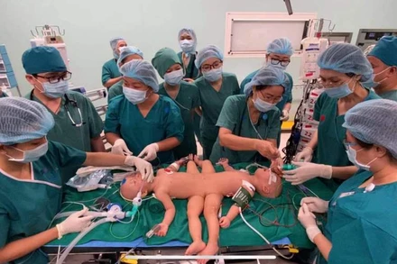 (Ảnh: Bệnh viện Nhi đồng thành phố)