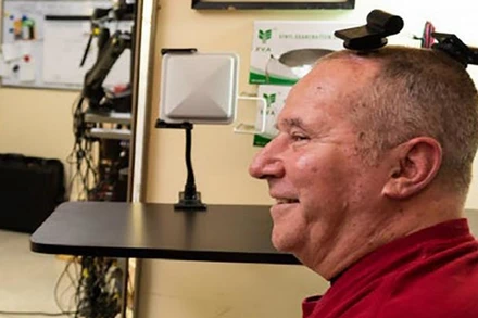 Một người tham gia thử nghiệm BrainGate sử dụng thiết bị phát sóng không dây thay thế dây cáp thường để truyền tín hiệu từ các cảm biến bên trong não. Ảnh: Braingate.