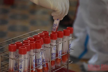 Gói mua sinh phẩm tháng 5/2021, Công ty Việt Á trúng thầu với CDC Đà Nẵng với tổng tiền gần 30 tỷ đồng. (Ảnh minh họa)