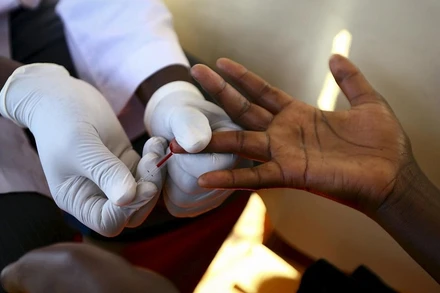 Lấy mẫu máu xét nghiệm HIV/AIDS tại 1 điểm xét nghiệm lưu động ở Ndeeba, ngoại ô thủ đô Kampala, Uganda. (Ảnh: Reuters)