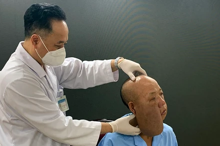 PGS, TS Trần Cao Bính, Giám đốc Bệnh viện Răng Hàm mặt Trung ương thăm khám cho bệnh nhân trước khi phẫu thuật.