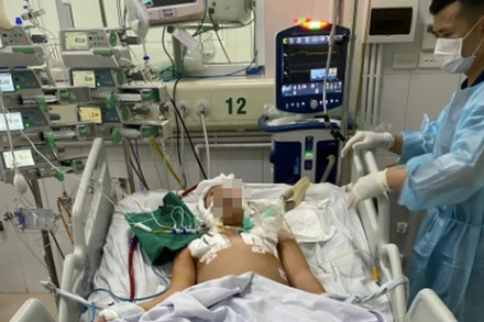 Bệnh nhi có 41 ngày phải can thiệp ECMO.