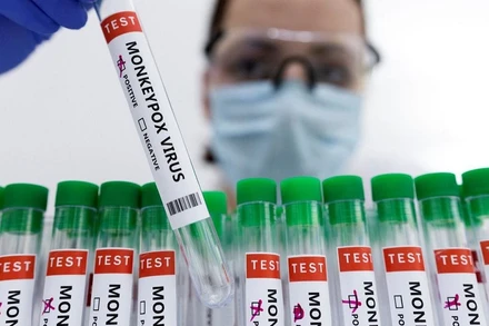 Các ống nghiệm dán nhãn "dương tính với virus đậu mùa khỉ". (Ảnh minh họa: REUTERS)