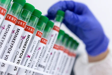 Ống đựng mẫu bệnh phẩm có đánh dấu dương tính với virus gây đậu mùa khỉ. (Ảnh: Reuters)