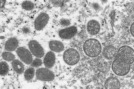 Hình ảnh virus đậu mùa khỉ dưới kính hiển vi điện tử. (Ảnh: AFP/TTXVN)