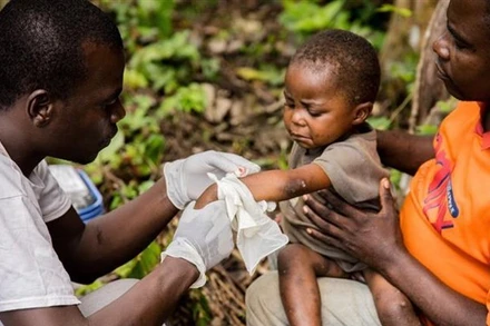 Điều trị cho bệnh nhân mắc bệnh đậu mùa khỉ. (Ảnh: AFP/TTXVN)