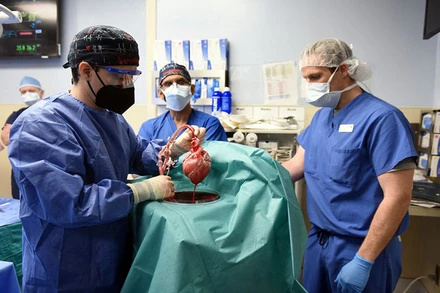 Ca cấy ghép tim lợn cho ông David Bennett diễn ra vào ngày 7/1, tại Baltimore, bang Maryland. (Ảnh do Trung tâm y tế Đại học Maryland cung cấp)