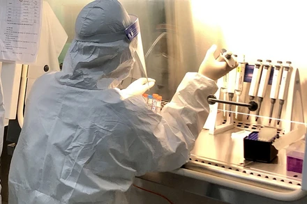 Cán bộ Trung tâm Kiểm soát bệnh tật Bắc Kạn xét nghiệm mẫu bệnh phẩm.