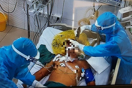 Các bác sĩ điều trị tích cực cho BN1045. (Ảnh: Báo SKĐS)