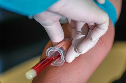 Phát hiện mới này củng cố hy vọng về vaccine Covid-19. Ảnh: EPA.