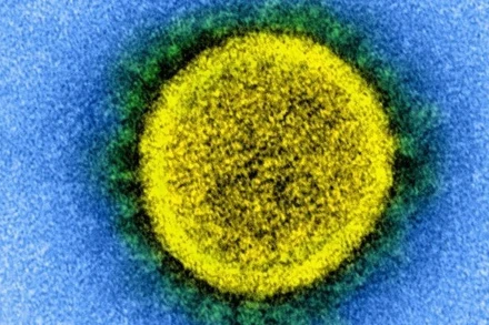 Sự lây truyền của virus SARS-CoV-2. Ảnh: NIH.