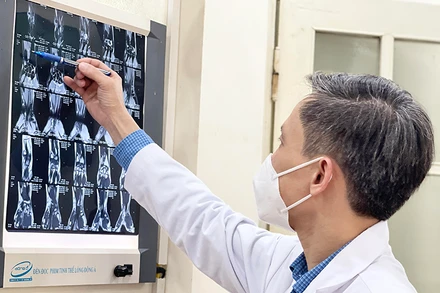 PGS,TS Nguyễn Mạnh Khánh xem hình ảnh MRI của bệnh nhân trước khi tiến hành phẫu thuật nội soi. 
