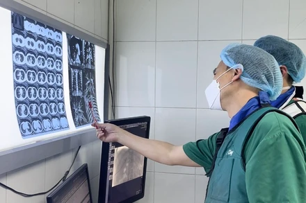 Các bác sĩ khoa Chẩn đoán hình ảnh hội chẩn trước can thiệp cho bệnh nhân.