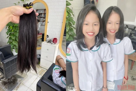 Lọn tóc buộc chun vàng - món quà đặc biệt của cặp đôi song sinh gửi tặng các bạn nhỏ đang mắc căn bệnh ung thư quái ác. (Ảnh: Gia đình cung cấp)