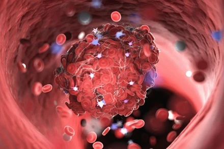 Ảnh minh họa. (Nguồn: weillcornell.org)