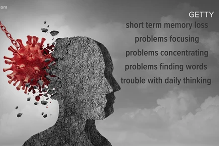 Covid-19 gây hội chứng "sương mù não" sau khi hồi phục (Ảnh: Gettyimages) 
