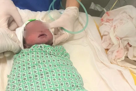 Một bé trai chào đời kỳ diệu tại bệnh viện Phụ sản Hà Nội