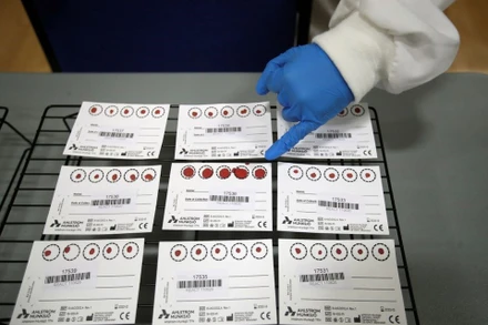 Các mẫu máu trong một thử nghiệm lâm sàng về các xét nghiệm đối với kháng thể Covid-19, tại Đại học Keele, ở Keele, Anh vào ngày 30/6/2020. Ảnh: Reuters.