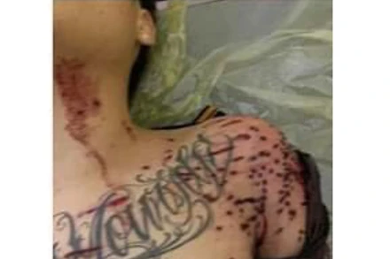 Nạn nhân Hoàng bất tỉnh ngay khi bị hàng chục vết đạn găm vào người.