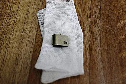 Nắp bật lửa được lấy ra từ bụng bé D.K.N.