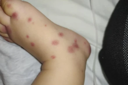 Bệnh nhi mắc căn bệnh cực hiếm trong y văn thế giới. 