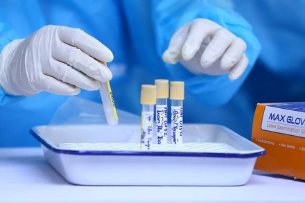 Trưa 22/7, Hà Nội thêm 34 ca dương tính với SARS-CoV-2