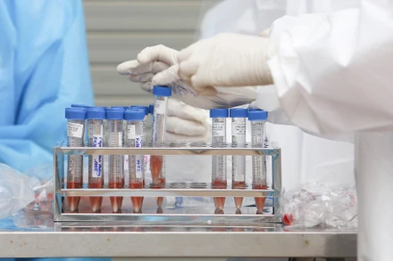 Nhiều bệnh nhân tử vong không phản ánh độc lực của SARS-CoV-2