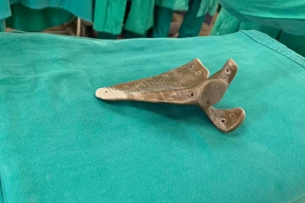 Bả vai làm bằng vật liệu sinh học. 