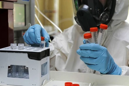 Sản xuất vaccine ngừa Covid-19 đầu tiên trên thế giới của Nga. (Ảnh: RDIF)