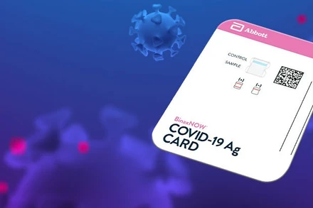 Bộ kit xét nghiệm Covid-19 mới có kích cỡ bằng thẻ tín dụng, không phải sử dụng thêm máy móc nào. Ảnh: AP