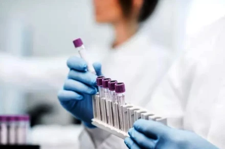 Xét nghiệm Covid-19 từ mẫu nước bọt rẻ hơn và ít xâm lấn. Ảnh: Shutterstock.