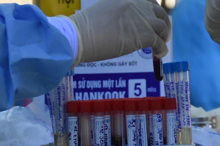 Đà Nẵng có ca tái dương tính với virus SARS-CoV-2 sau 18 ngày xuất viện. (Ảnh minh họa)