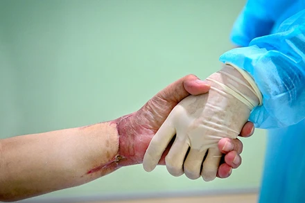 Cuộc sống mới của người đàn ông Việt Nam đầu tiên được ghép tay